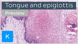 Tongue and epiglottis histology (preview) - Human Anatomy | Kenhub