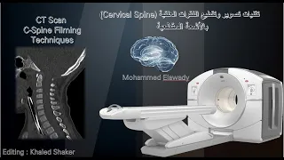 تقنيات تصوير وتقطيع الفقرات العنقية بالاشعة المقطعية |CT Scan Cervical Spine Imaging Techniques