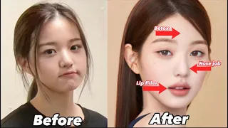 Ive Wonyoung EXTREME plastic surgery