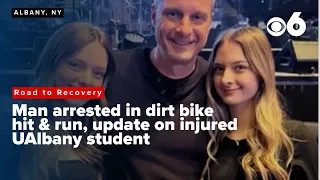 Arrest made as UAlbany student continues to recover following illegal dirt bike hit and run