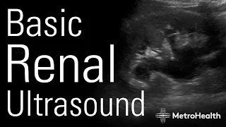 Basic Renal Ultrasound