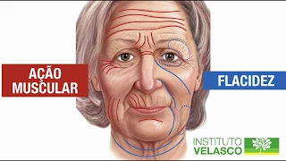 Parte 6 - Análise das Marcas Faciais