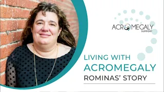 Living With Acromegaly: Romina's story