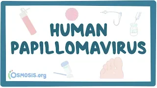 Human papillomavirus or HPV