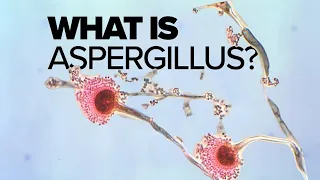 What is Aspergillus mold?