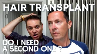 Do I need ANOTHER Hair Transplant?