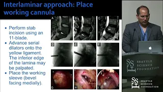 Endoscopic Lumbar Spine Surgery - Christoph P. Hofstetter, MD, PhD