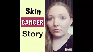 Skin Cancer at 23 | Surviving Melanoma | Surgery & Skin Graft