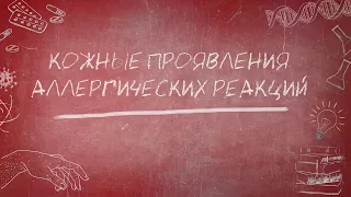 Кожные проявления аллергических реакций