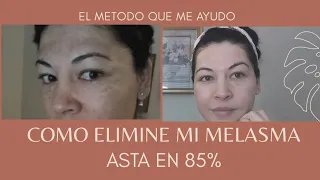 Mi metodo que me ayudo a eliminar casi por completo mi melasma.