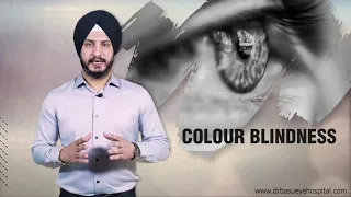 It is possible to treat COLOR BLINDNESS | Dr Basu Eye Hospital