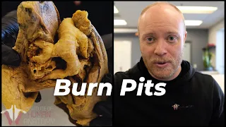 How Burn Pits Are Killing Military Veterans