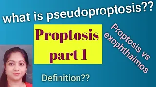 Proptosis// Exophthalmos// Pseudoproptosis// Causes for psuedoproptosis// MBBS// Ophthalmology