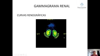 Gammagrama renal – Utilidad en Uro Nefro