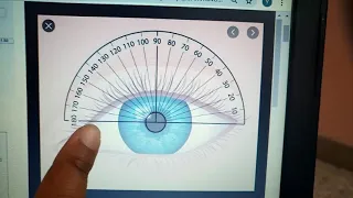 ASTIGMATISM complete concept with diagrams    made easy  part 1