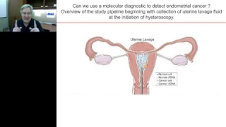 John Martignett -The Pandora's box of molecular diagnostics: Genomic analysis of uterine lavage....