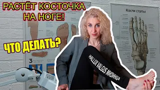 🦶Почему я пошла к подологу🦶Боль в мизинце на ноге🦶Hallux Valgus мизинца