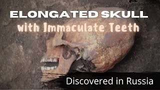 Elongated Skull with Immaculate Teeth Discovered in Russia