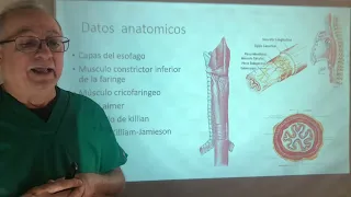 Diverticulo esofágico de Zenker. Diverticulos verdaderos y falsos. Diverticulo epifrenico