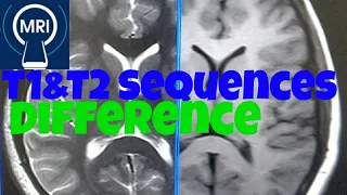 Difference between T1 and T2 In MRI. what is T1 and T2 T1 and T2 sequence in MRI