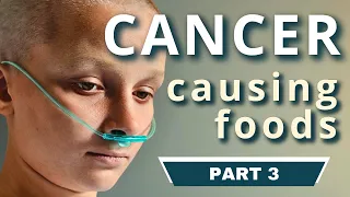Cancer Causing Foods | The WORST Food that Feeds Cancer Cells - PART 3