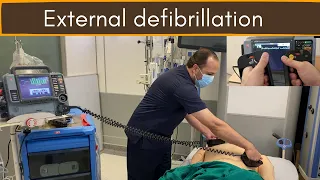 External defibrillation (DC Shock)