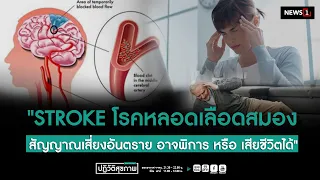 " STROKE โรคหลอดเลือดสมอง สัญญาณเสี่ยงอันตรายอาจ พิการ หรือ เสียชีวิตได้ "