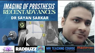 IMAGING OF PROSTHESIS & RECENT ADVANCES | SAYAN SARKAR | PROSTHESIS COMPLICATIONS IMAGING