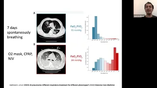 Ventilation and Lung Ultrasound - Dr Hatem Soliman Aboumarie