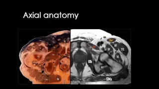 Imaging of Hip joint Mar 2013   Dr Mamdouh Mahfouz In Arabic