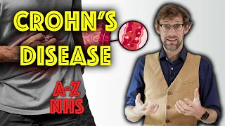 Teach me about Crohns and Inflammatory bowel disease - A to Z of the NHS - Dr Gill