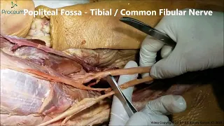 Tibial nerve, Common Fibular Nerve & Plantar nerve - Real Time Cadaveric Anatomy