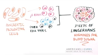 Progress and Promise of Stem Cell Research: Type 1 Diabetes