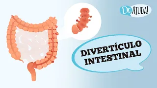 DOENÇA DIVERTICULAR E DIVERTICULITE: SINTOMAS, DIAGNÓSTICO E TRATAMENTO