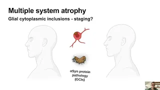 Alpha-Synuclein Strains in Synucleinopathies