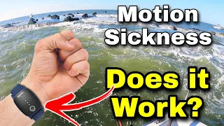 Does it Work? Motion Sickness Wristband