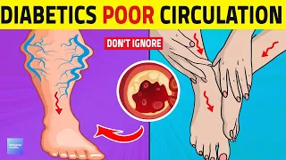 6 Ways Diabetes Leads To Poor Circulation