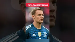 Neuer:"I have had skin Cancer"