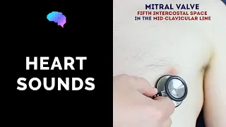 Heart murmur sounds (cardiac auscultation sounds) | UKMLA | CPSA