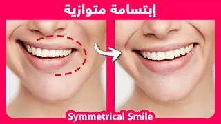 How to naturally fix smile asymmetry