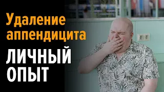 Как мне удаляли аппендицит