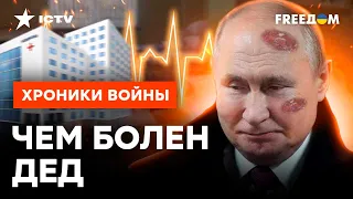 Кремлю ВЫГОДНО, ЧТОБЫ ПУТИН "БОЛЕЛ"! Сколько протянет БУНКЕРНЫЙ @skalpel_ictv