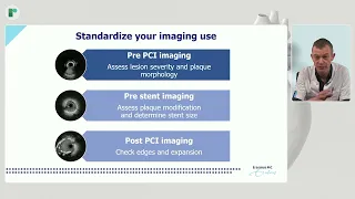 IVUS-Guided Bifurcation PCI with HDi IVUS - Radcliffe Cardiology