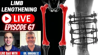 Limb Lengthening LIVE - Episode 67 - LIVE Presentation w/ Dr. Franz Birkholtz - South Africa