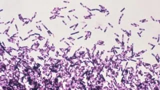 Clostridium difficile: Preventing Infections