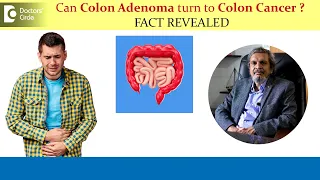 MYTH BUSTED- Can Colon Adenoma turn to Cancer? | Colon Polyp - Dr. Rajasekhar M R | Doctors' Circle