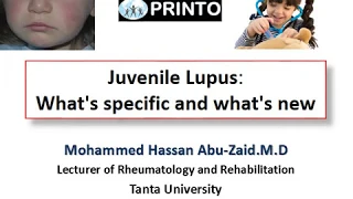 juvenile lupus