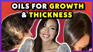 BEST OILS FOR HAIR LOSS AND GROWTH | HOW I BEAT FEMALE HAIR LOSS