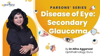 Secondary Glaucoma | Dr. Niha Aggarwal | DBMCI