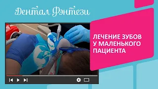 🦷 Лечение зубов у маленького пациента без страха